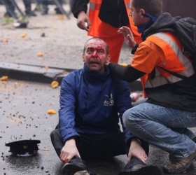 diadilosi-traumatias-Brussels
